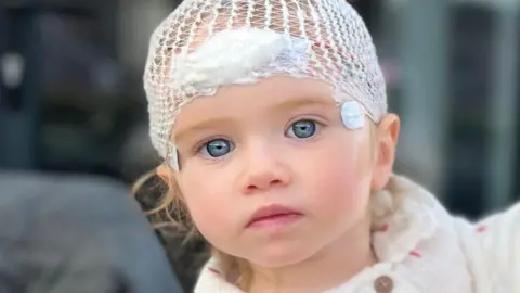 Tilly looks into camera with hospital dressings on her head at Sheffield Children's Hospital.