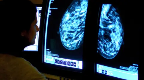 A consultant analysing a mammogram of a woman's breast in order check for breast cancer. 