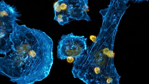 PA Media A scan of cancer cells showing blue shapes with yellow spots on a black background.