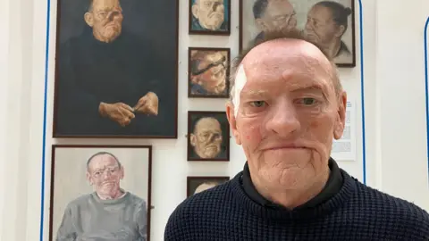 Nicola Rees/BBC A man wearing a navy blue jumper and with a white plaster on the right side of his face above the eye stands in front of a wall of pictures. Behind him are two portraits, one of the man without his facial prosthesis and one with. There are five smaller portraits of the man.