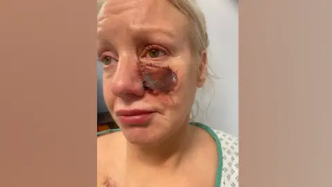 PA Kelly Allen with an open wound to her face