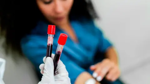 Getty Images A woman puts a piece of cotton wool onto her arm after giving blood. In the foreground of the picture, a healthcare professional holds two samples of blood in a gloved hand.