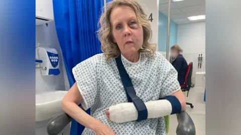 Jilly, in a hospital gown, in a wheelchair, in a hospital, with her arm bandaged and in a sling, and a very swollen and bruised face. 