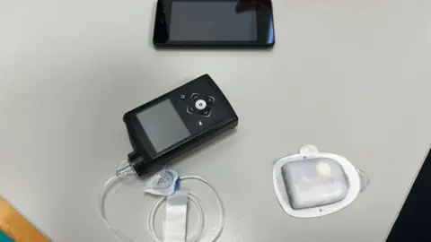 Overhead view of diabetes monitoring equipment on a tabletop, including a smartphone, a black handheld insulin pump with clear tubing, and a small adhesive glucose sensor patch placed beside it.