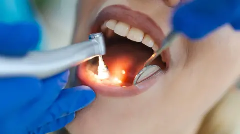 Getty Images A dentist holds tools in a patient's mouth to examine their teeth