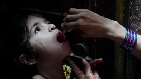 Getty Images A health worker administers polio vaccine drops to a young girl during a polio vaccination campaign in Karachi on June 3, 2024.