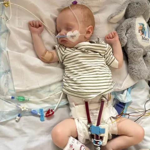 Family Photo Macs Green is a small baby. He is lying in a hospital bed with tubes coming from his face and body.