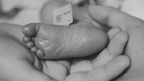 Remember My Baby A baby's foot is cradled in the hands of his parents, with his hospital tag seen attached around his ankle. The image is in black and white. 