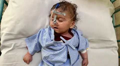 Aakriti Thapar / BBC Musryha está acostado en la cama y los tubos en la nariz. Es un bebé desvaído, con cabello oscuro. Él lleva un hospital revisando el azul