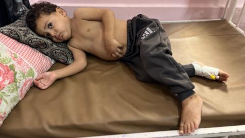 Desperation in Gaza: Children Awaiting Lifesaving Evacuations