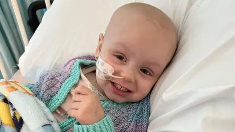A young girl with no hair and a visible scar on her skull smiling in a hospital bed. She has an nasogastric tube in her nose.