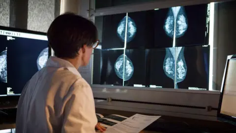 Getty Images A female doctor faces away from us, looking at a large display screen showing mammogram scans.
