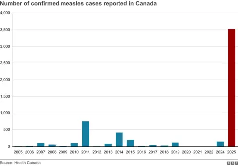 Um gráfico mostrando o número de casos de sarampo confirmado no Canadá nos últimos 10 anos, com 2025 sendo significativamente maior que os anos anteriores.