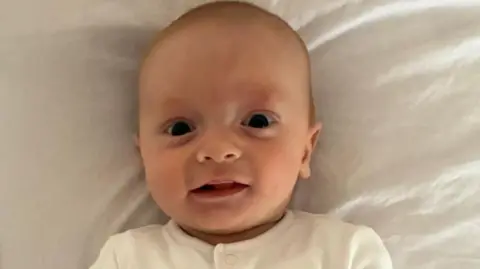 A baby is pictured lying down on white bed sheets, looking at the camera.