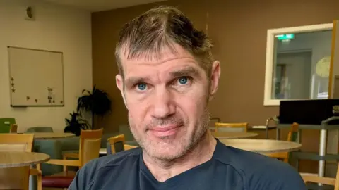 A man looks at the camera. He has blue eyes and is wearing a dark blue shirt. He has a big dent on his head, resulting from a brain injury he suffered from a fall.