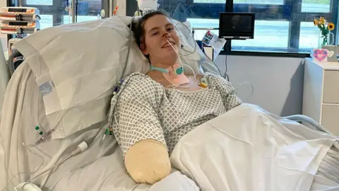 BBC Lily in hospital after having all four limbs amputated
