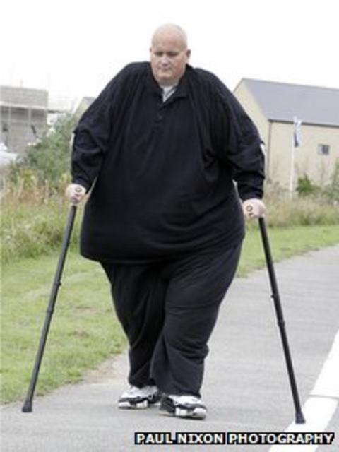 Man Branded World s Fattest Tells Of 24 7 Eating Illness BBC News