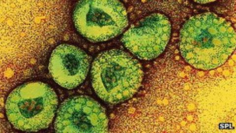 Second UK Case Of 'Sars-like' Coronavirus Identified - BBC News