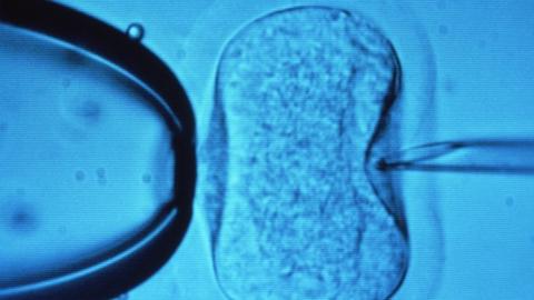 'Shoebox IVF' hope for infertile couples - BBC News