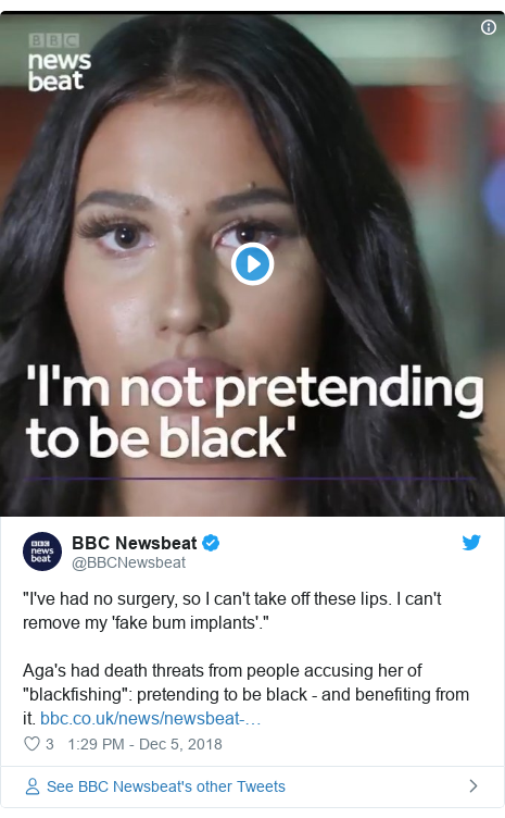 Twitter post by @BBCNewsbeat: "I've had no surgery, so I can't take off these lips. I can't remove my 'fake bum implants'." Aga's had death threats from people accusing her of "blackfishing" pretending to be black - and benefiting from it. 