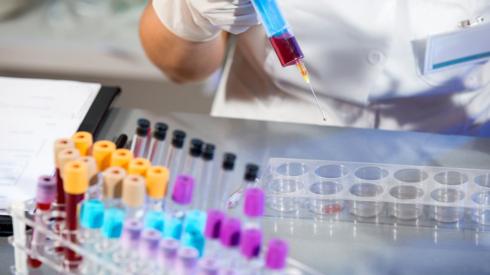 Blood samples being tested in a laboratory