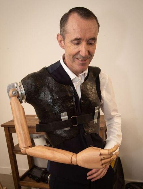 Leeds Man Makes New Arm Out Of Mannequin c News