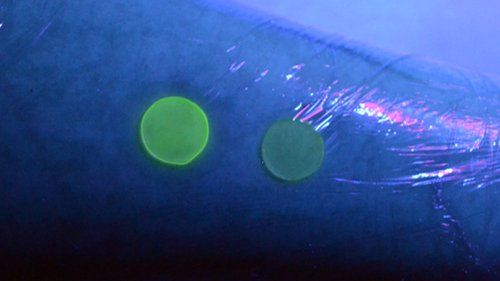 How the fluorescent dye would look on an arm if the wound was infected
