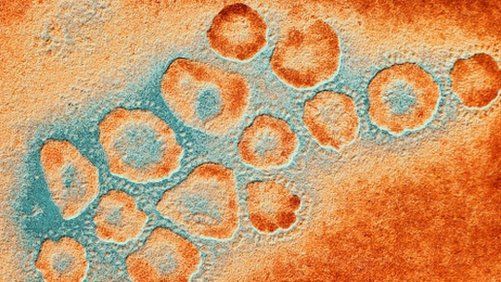 Coronaviruses include Sars, the common cold and Mers