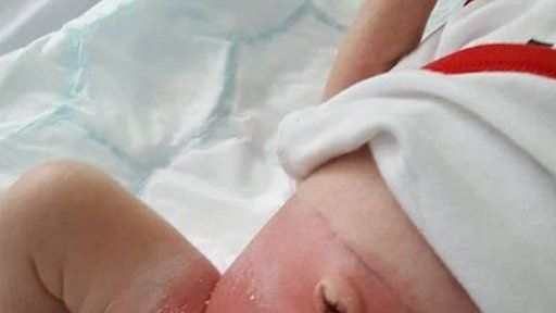 Supermarket recalls newborn nappies range to investigate 'burns'