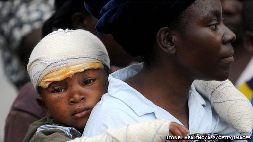 A mother and a child wait for the arrival of United Nations Secretary General Ban-Ki Moon at Heal Africa hospital on 28 February 2009 in Goma.