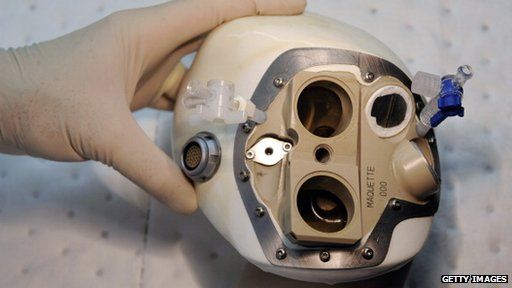 first artificial heart transplant 1982