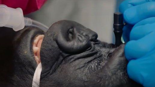 the gorilla has its eye inspected