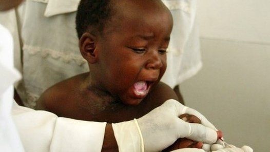 A young patient on a malaria vaccine trial cries