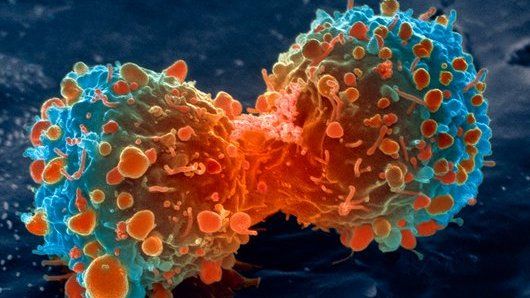 Lung cancer cell