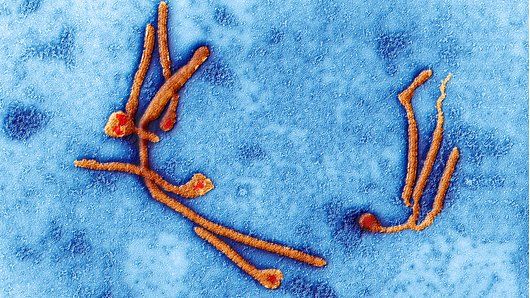 Ebola virus under the microscope