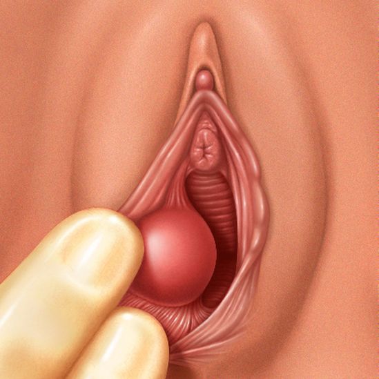 porque se me hinchan los labios dela vulva