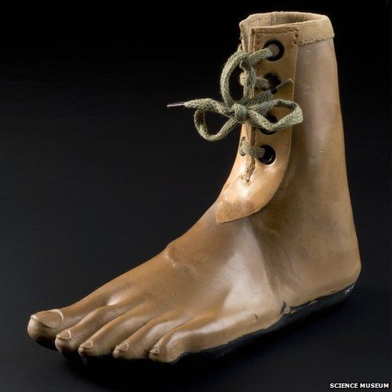 A foot. Credit: Science Museum, Brought to Life exhibit