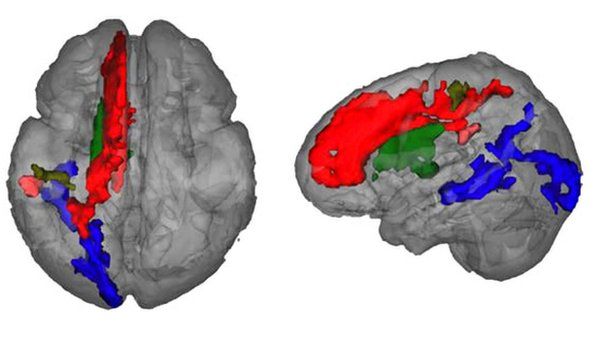 Regions of the brain that show leftward asymmetry of myelin