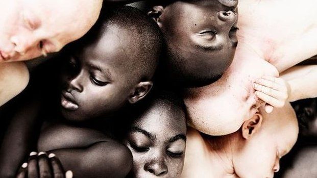 Tweeted photo of albino and black-skinned Africans