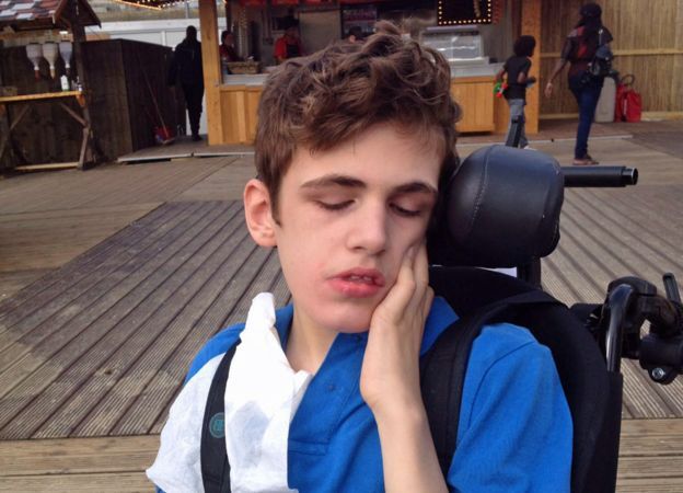 As crianças que vivem com as doenças mais raras do mundo - BBC News Brasil