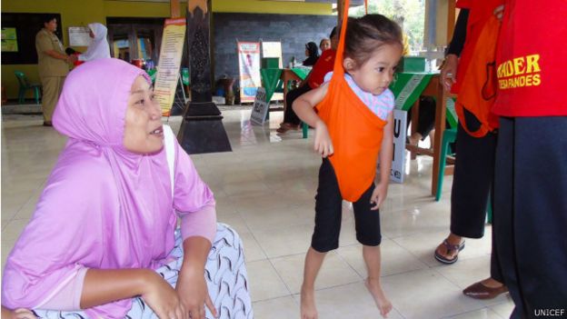 Obesitas dan malnutrisi, dua masalah anak Indonesia - BBC News Indonesia