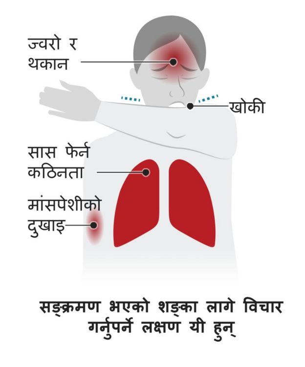 कोरोनाभाइरस सङ्क्रमण