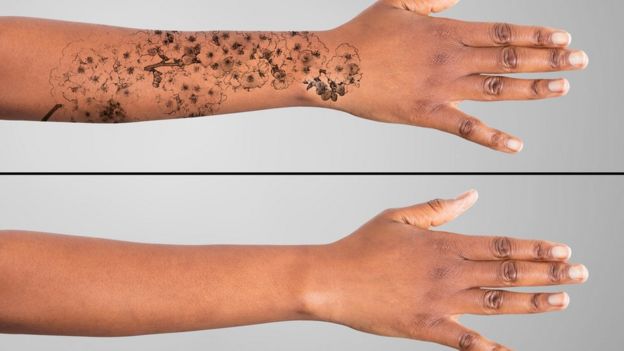 Comparación de un brazo con tatuaje y otro sin tatuaje.