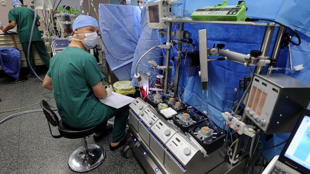 Un técnico en oxigenación extracorpórea durante una cirugía a corazón abierto en Francia.