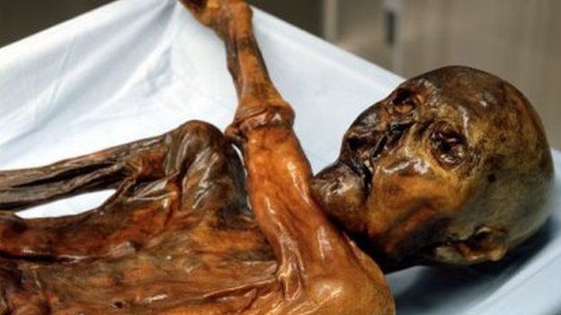 Ötzi