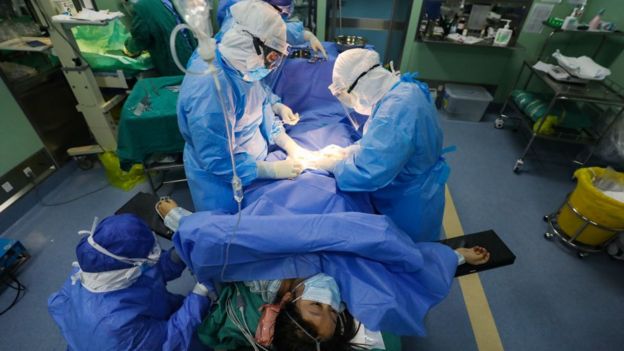 Un grupo de médicos realizan una cesárea a una mujer que se sospecha es portadora del covid-19 en Wuhan (China)