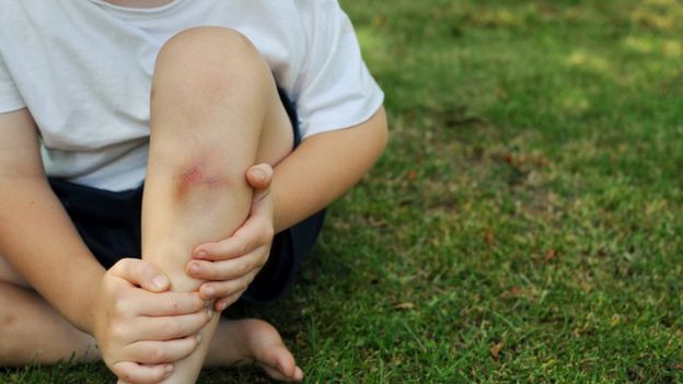 Criança com machucado na perna