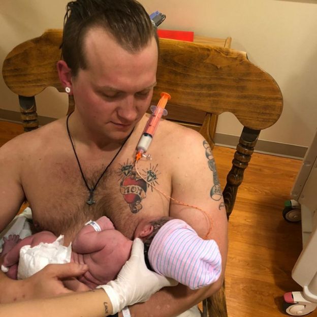 பிறந்த மகளுக்கு தன் மார்பில் பாலூட்டிய தந்தை