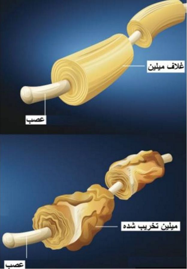 ام اس