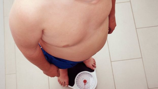 An overweight child stands on scales